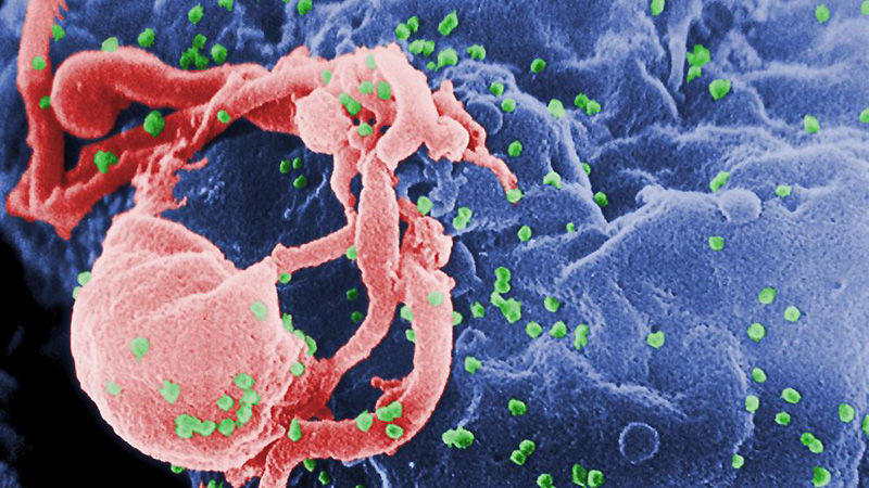 Здоровье: Новая надежда: доктора учатся лечить ВИЧ