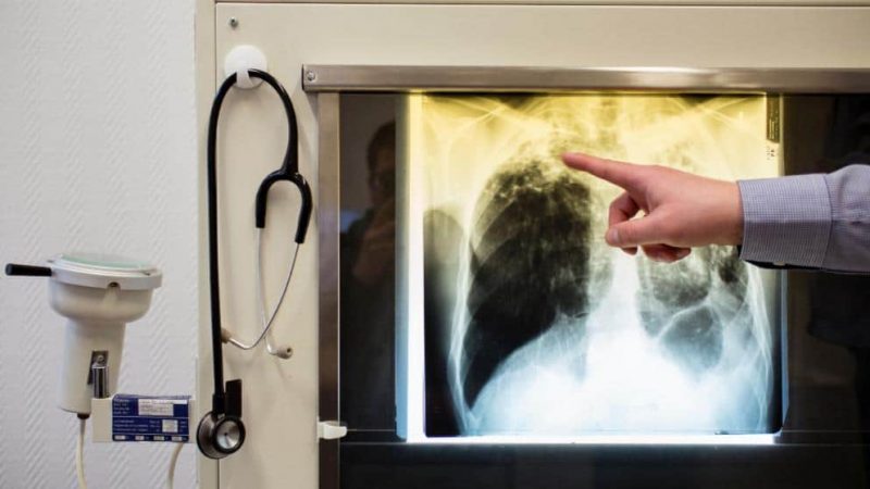 Здоровье: На заводе Volkswagen работал сотрудник с открытой формой туберкулеза