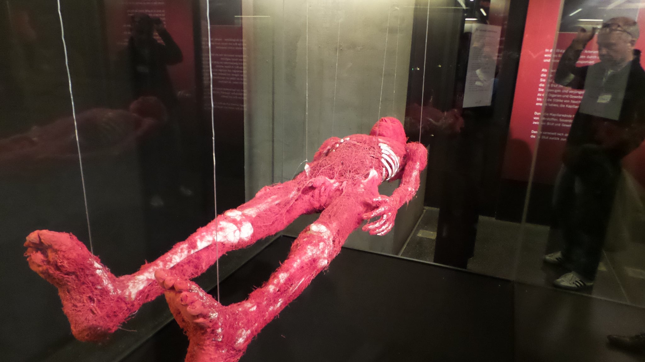 Галерея: В Гейдельберге открылась выставка человеческих тел рис 3