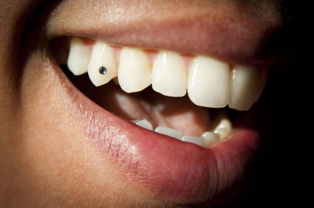 Домашние хитрости: Стразы на зубах: красота, за которой скрывается опасность