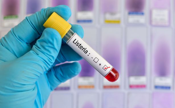 Здоровье: В Европе – вспышка листериоза: что это такое и как защититься от опасной инфекции