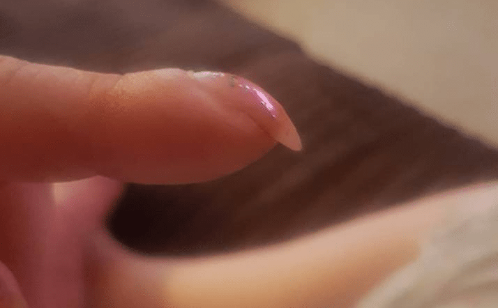 Здоровье: Если ваши ногти имеют такую форму, немедленно обратитесь к врачу