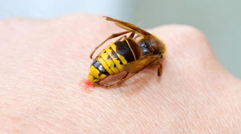 Домашние хитрости: Укус осы, пчелы или шершня: нужно ли высасывать яд и как обработать место укуса?