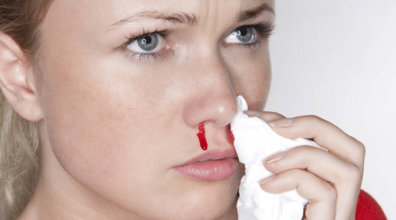 Здоровье: Носовое кровотечение: причины появления, способы остановки