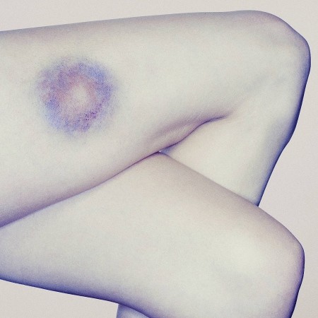 Общество: Что женщины должны знать о домашнем насилии