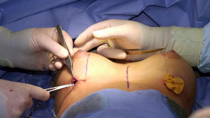 Общество: Низкопробные имплантанты продолжают калечить пациентов