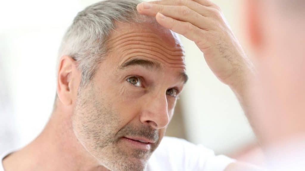 Здоровье: Выпадение волос у мужчин: выход есть!
