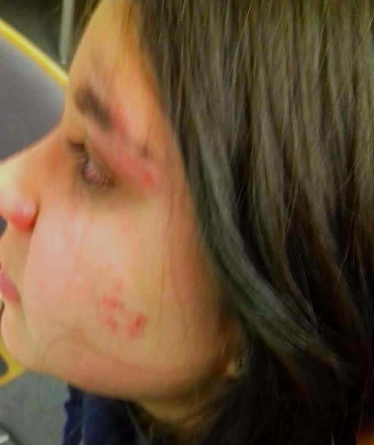 Происшествия: Насилие в бременской гимназии: старшеклассницы жестоко избили 13-летнюю Сару