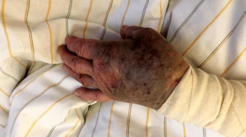 Происшествия: Преступники избили и ограбили 94-летнюю пенсионерку