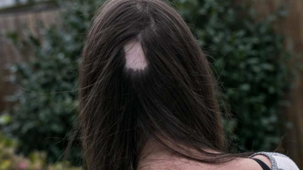 Происшествия: Кельн: девушка сходила к парикмахеру и навсегда лишилась части волос