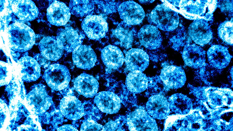 Общество: Обнаружен новый симптом коронавируса, который проявляется у детей