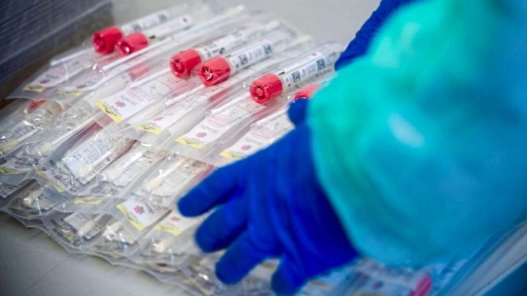 Общество: В Баварии бесплатный тест на коронавирус теперь сможет сдать каждый, даже не имя симптомов болезни