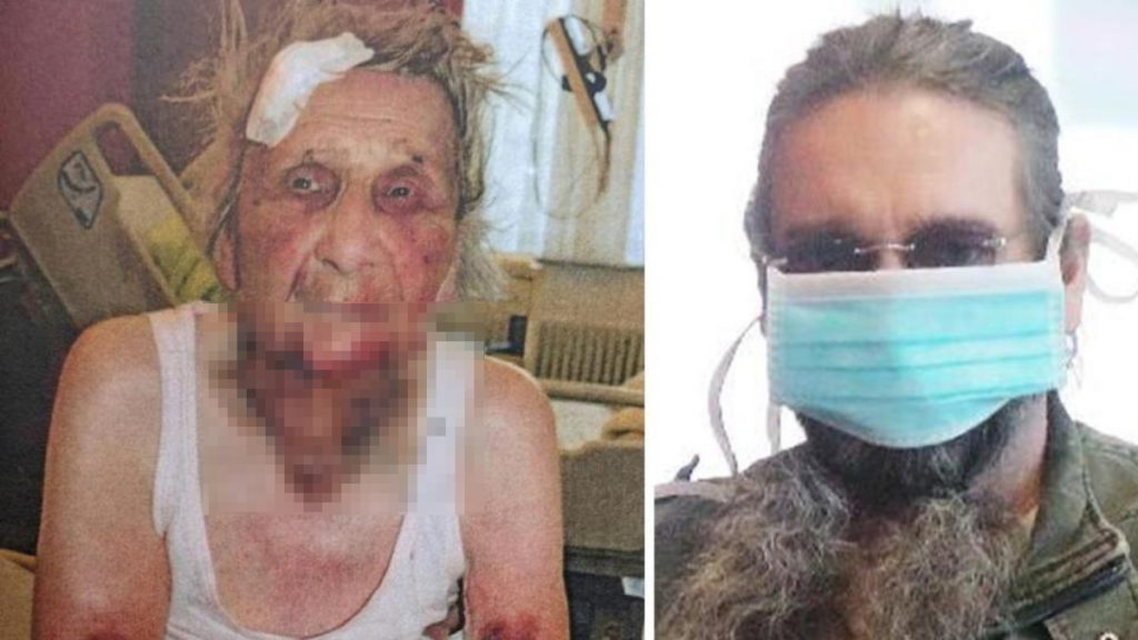 Происшествия: Сломанные кости и кровоподтеки: внук навестил 98-летнюю пенсионерку и жестоко избил ее
