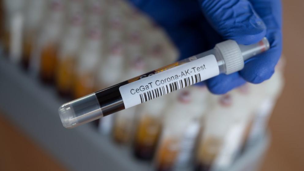 Общество: Немецкие клиники навязывают пациентам бесполезные тесты на антитела к Covid-19