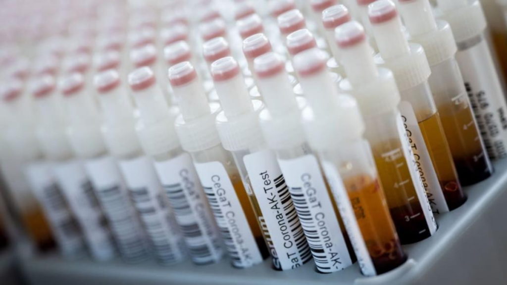 Общество: Заболеваемость растет: за сутки в Германии зарегистрировали почти 1500 новых случаев заражения коронавирусом