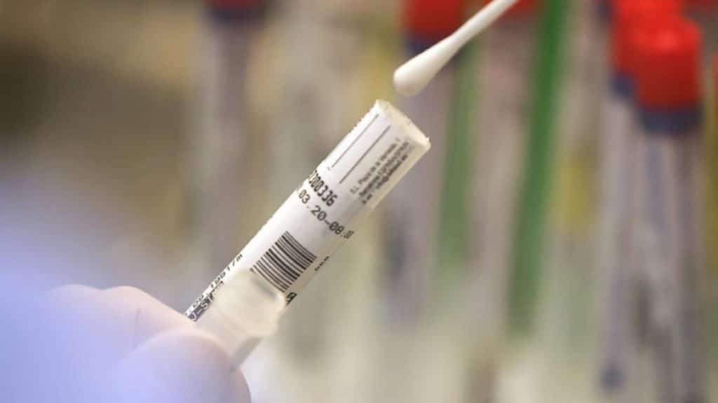 Общество: В Германии новый антирекорд: за сутки коронавирусом заболело 7830 человек