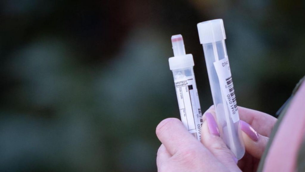 Общество: Почему немецкие медики против домашних экспресс-тестов для выявления коронавируса