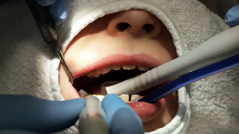 Происшествия: Смерть в стоматологическом кресле: кто виновен в гибели четырехлетней Эмилии?