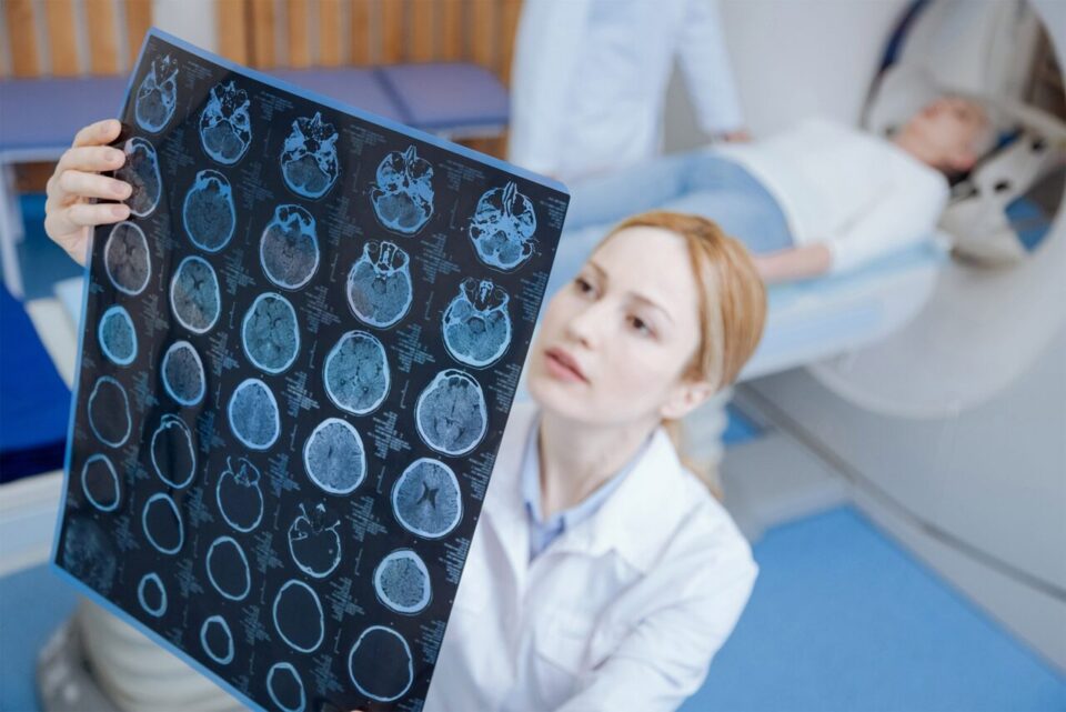врач рассматривает мрт снимок головного мозга