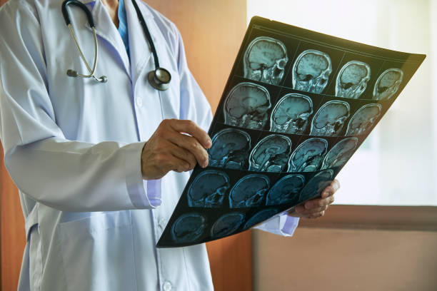 врач держит снимок человеческой головы